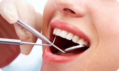 Trồng răng Implant vài răng