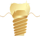 Trụ Implant nha khoa chất liệu cao cấp, minh họa cho dịch vụ cấy ghép Implant và trồng răng giả vĩnh viễn