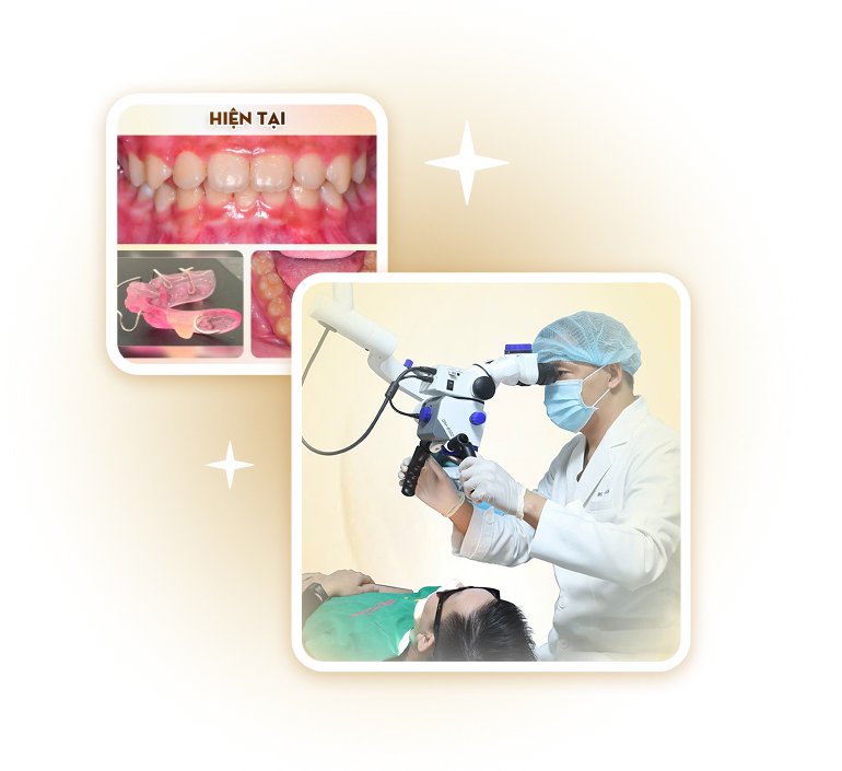 Ứng dụng kính hiển vi nha khoa và chỉnh nha hiện đại – dịch vụ chuyên sâu tại Nha khoa Phương Thành
