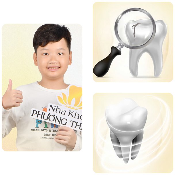 Niềng răng trẻ em